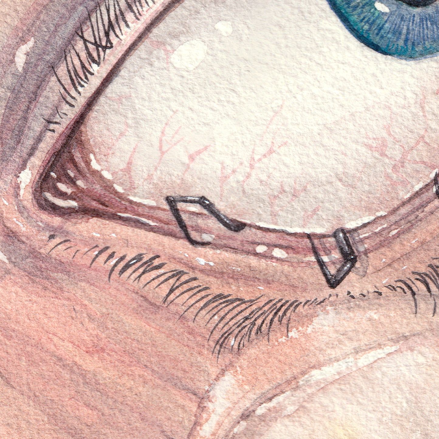 Narcoleptic Nightmare